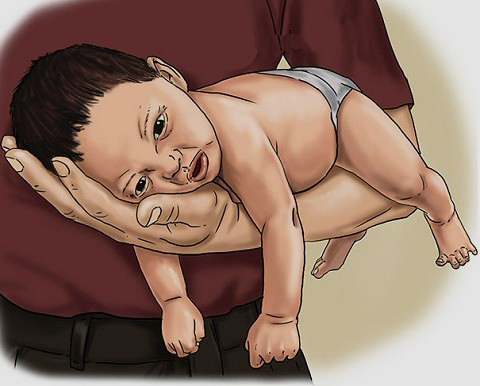 IL NEONATO NON SMETTE DI PIANGERE