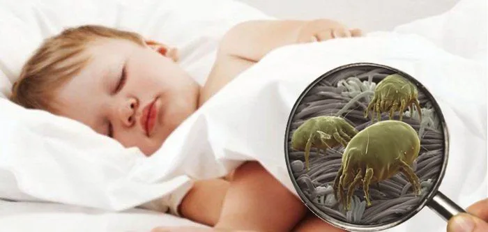 Punture Di Acari Sui Bambini: Come Riconoscerle